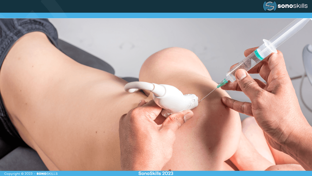 Mastering Ultrasound-Guided Musculoskeletal Interventions