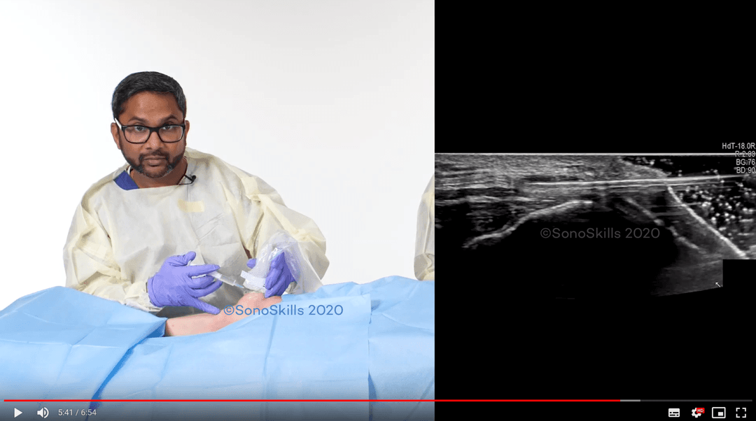 Top-ten tips for ultrasound guided joint injections