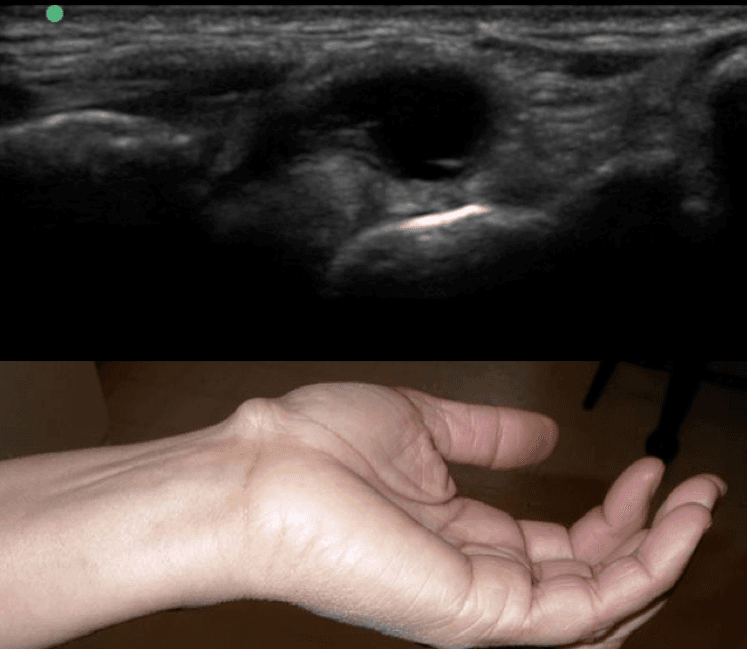 Ultrasound as an extension to physical examination