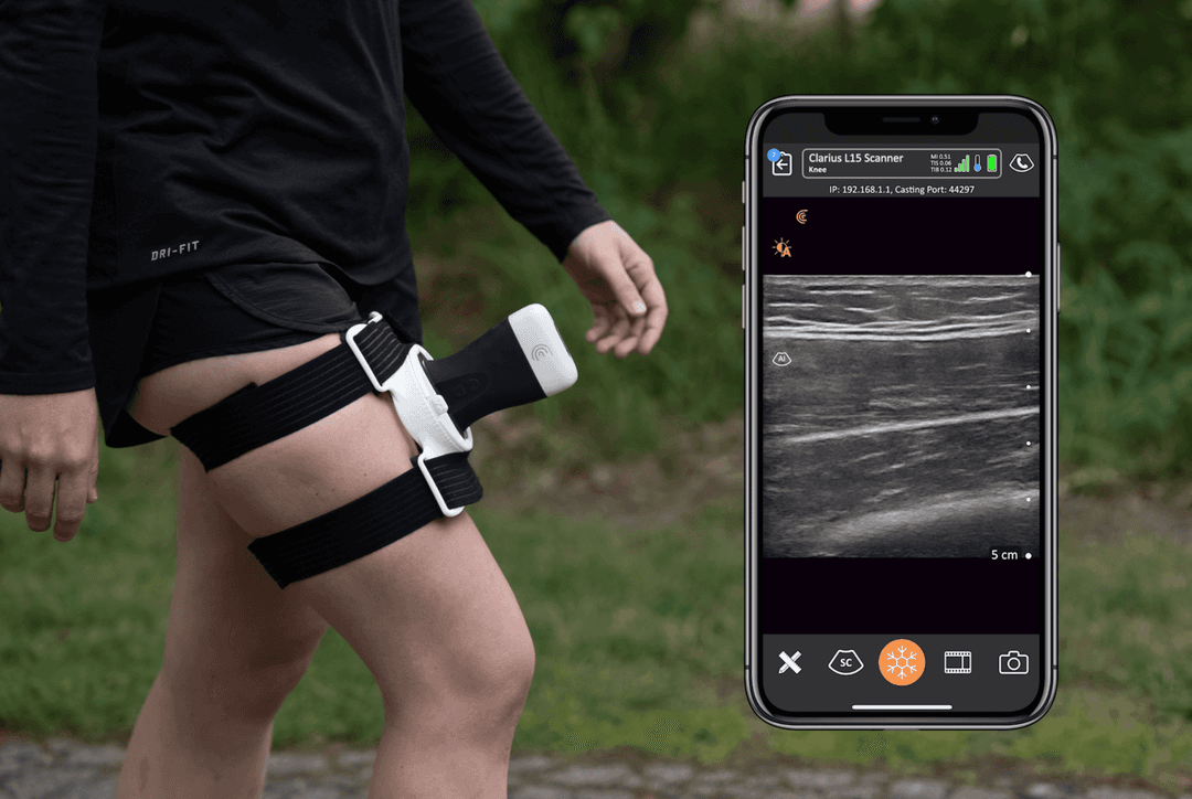 Embracing the Future: Emerging Trends in Musculoskeletal Ultrasound