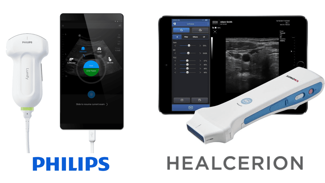 Assessing shoulder patients with pocket sized ultrasound