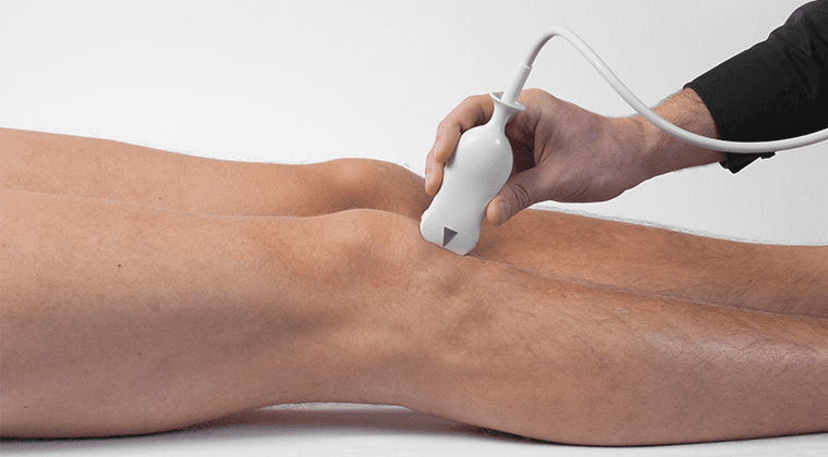 Ventral Knee Pain: Best MSK Ultrasound Practices
