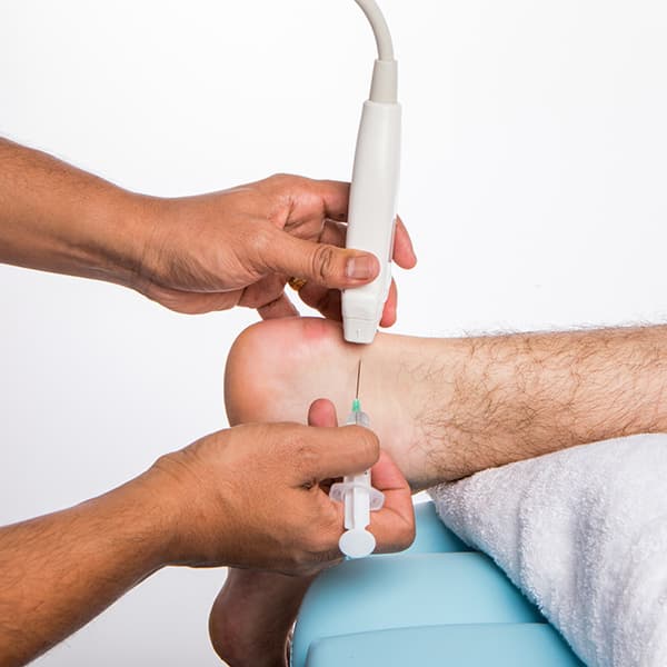 Ultrasound-guided Shockwave Therapy and Interventions of the Lower Extremity