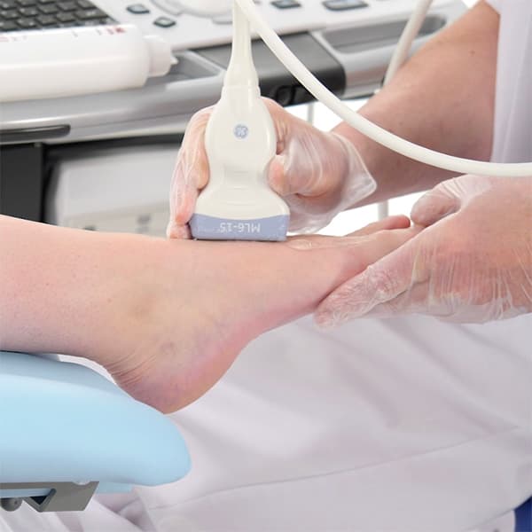 Ultrasound Assessment of Midfoot Ligaments
