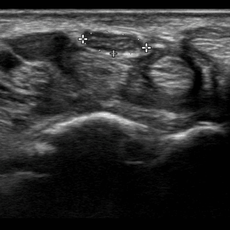 Neuromuscular Ultrasound eLearning