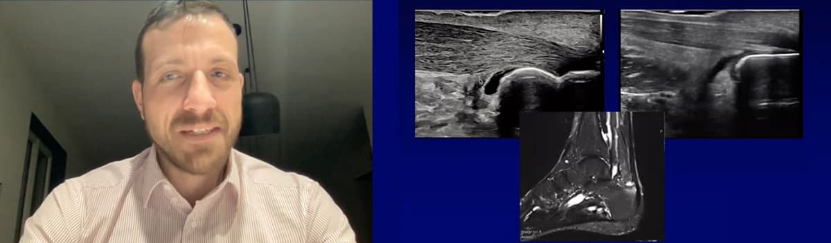 Pathologies in MSK Ultrasound versus other medical imaging techniques