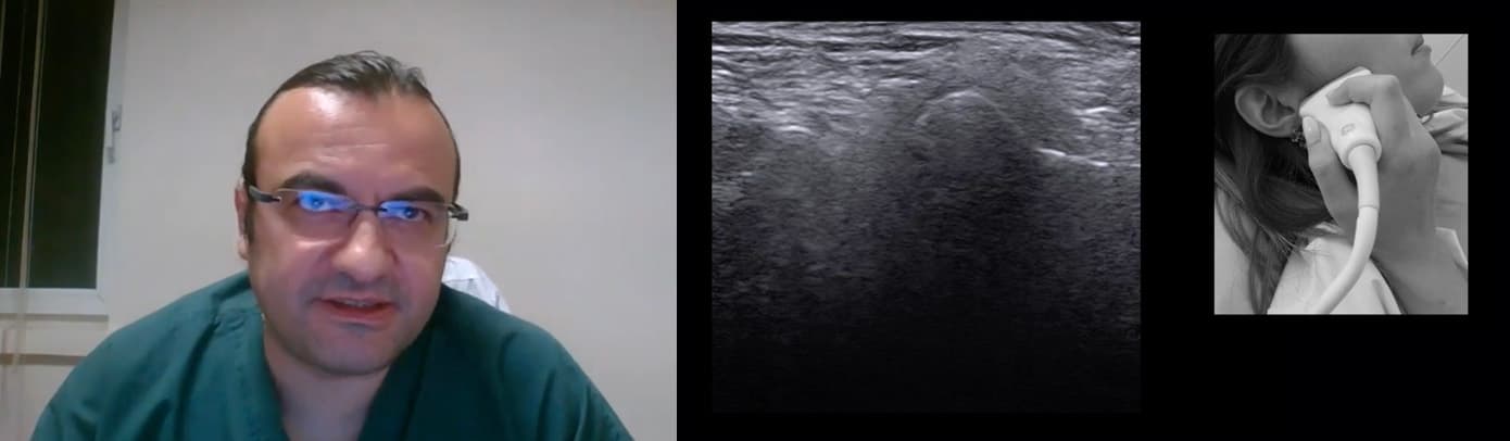 MSK Ultrasound of the Temporomandibular Joint