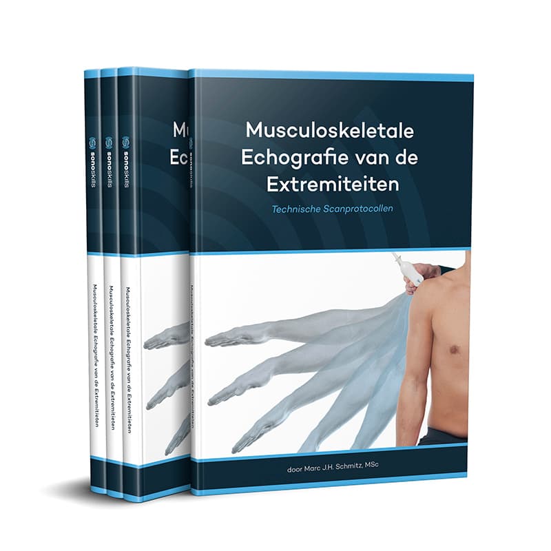 Musculoskeletale Echografie van de Extremiteiten - Technische Scanprotocollen
