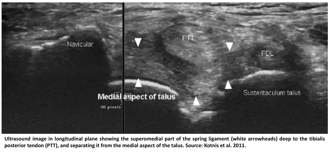 Anatomy, pathology and guideline for scanning the spring ligament in the foot