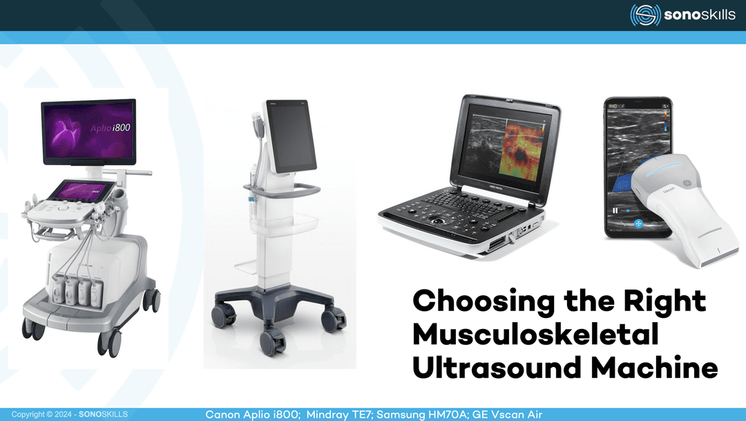 Choosing the Right MSK Ultrasound Machine