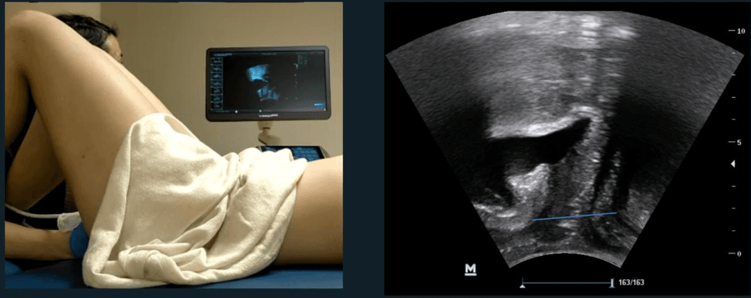 The Role of Musculoskeletal Ultrasound in Pelvic Floor Disorders and Rehabilitation