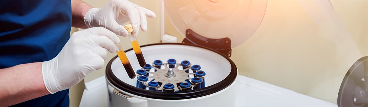 Platelet-Rich-Plasma (PRP) Interventions in MSK Practice