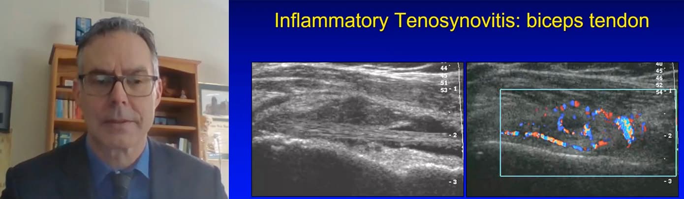 Pearls & Pitfalls in MSK Ultrasound Technique and Diagnosis