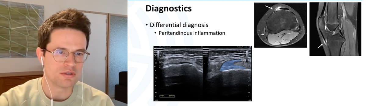 Managing Tendinopathy: the use of ultrasound