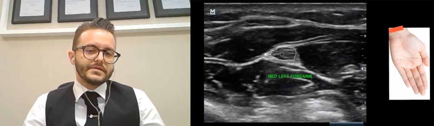 An Ultrasound Insight into the Peripheral Nervous System