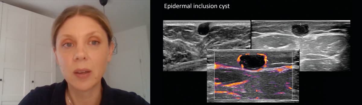 Essential Non-MSK Pathologies for the MSK Sonographer