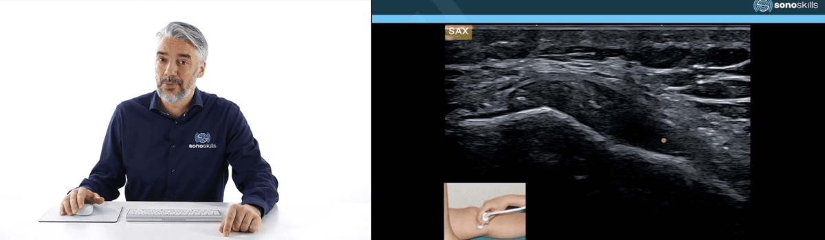 Detecting Medial Knee Pain with Musculoskeletal Ultrasound