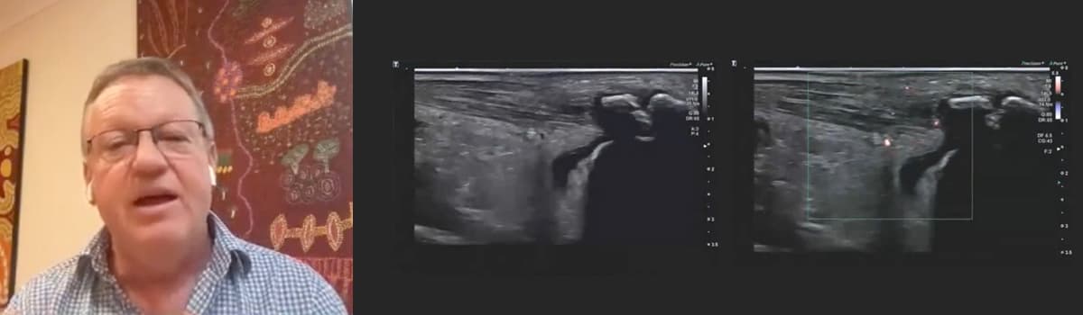 The Traumatic Ankle: A Systematic Ultrasound Approach