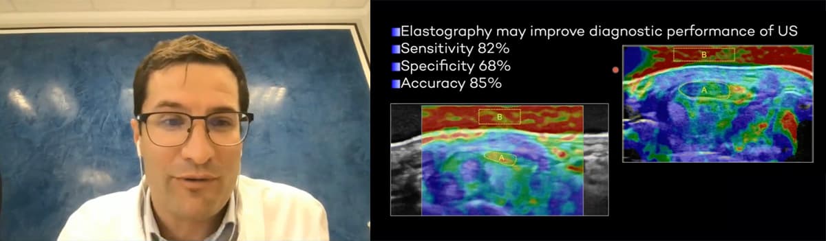 Elastography in MSK Ultrasound