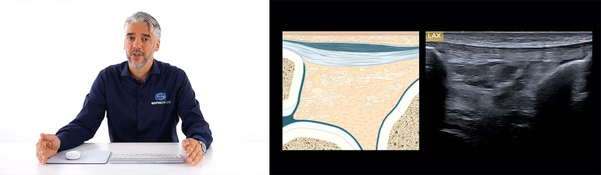 Ventral Knee Pain: Best MSK Ultrasound Practices