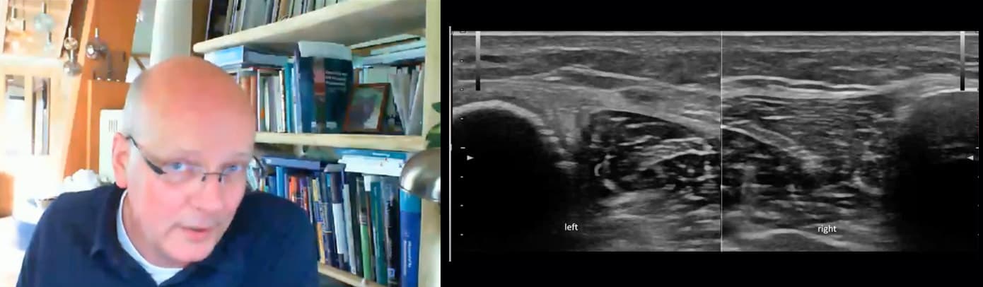 MSK Ultrasound of the Ankle & Foot