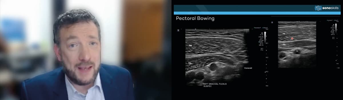 Feeling the Pinch: Brachial Plexus and Thoracic Outlet Demystified