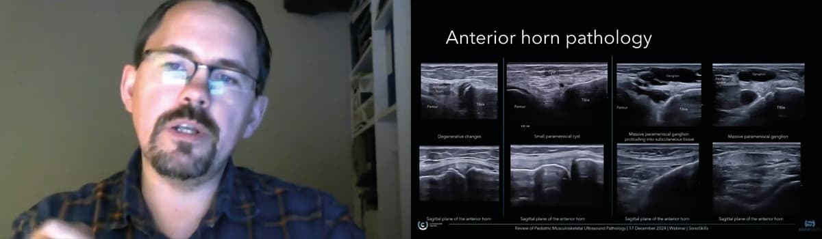 Review of Pediatric Musculoskeletal Ultrasound Pathology