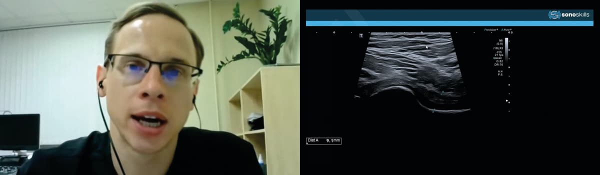 Point-of-Care Ultrasound for Pain Diagnosis: Hip to Knee