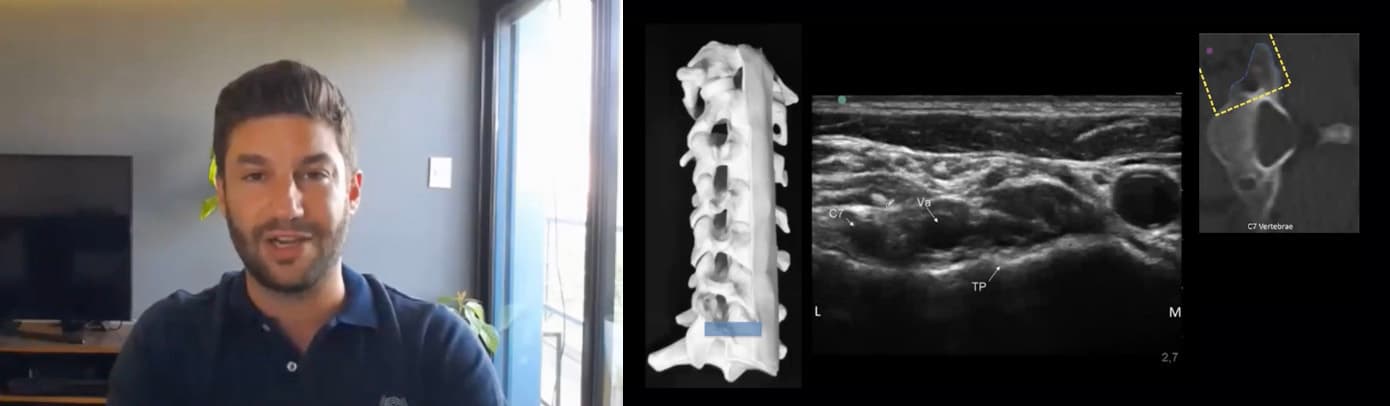 Ultrasound and Intervention of Cervical and Thoracic Spine