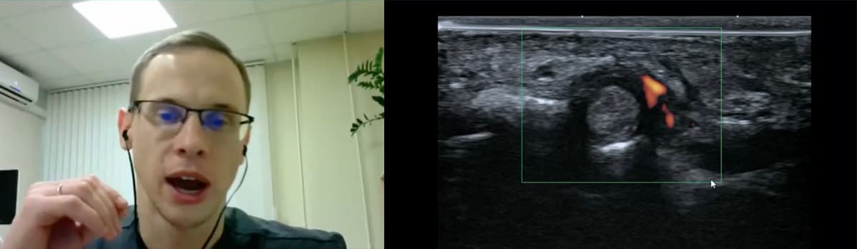 MSK Pain in the Elbow, Wrist and Hand: A Point-of-Care Ultrasound Approach