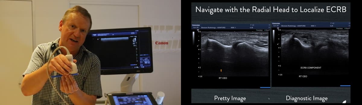Musculoskeletal Ultrasound Pathology Principles