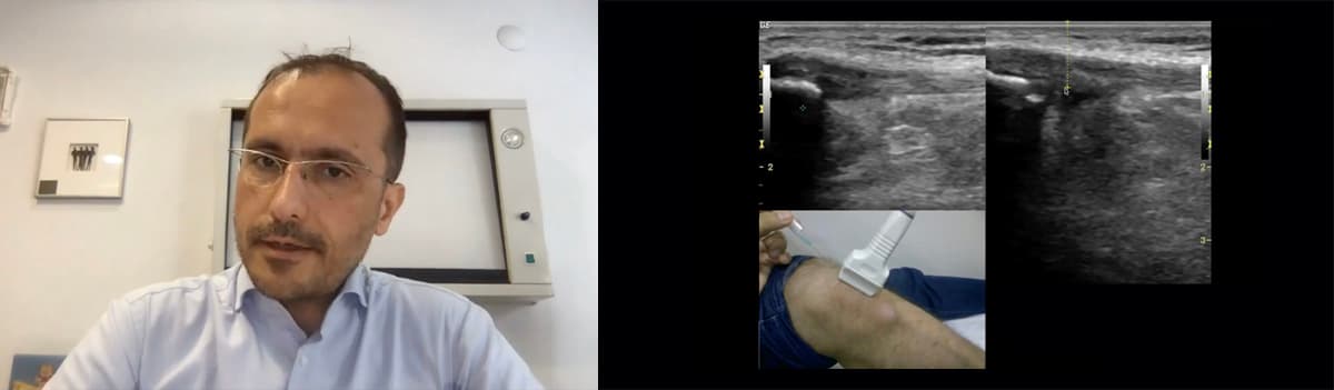 Ultrasound Imaging and Guidance for Musculoskeletal Interventions
