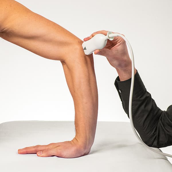 Cubital Tunnel Syndrome: Diagnostics, Pathology and US-guided Tunnel release