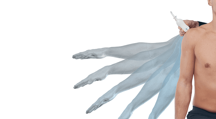 Diagnostic and Interventional MSK Ultrasound Of Subacromial Pain Syndrome