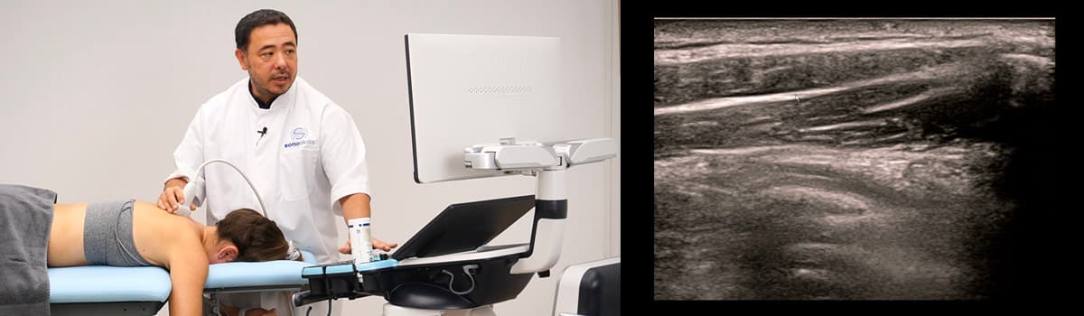 Ultrasound-Guided Spine Interventions: Cervical, Thoracic, Lumbar and Sacrum