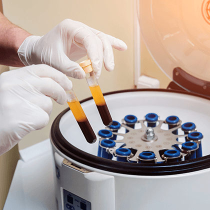 Role of PRP within MSK & Sports Medicine