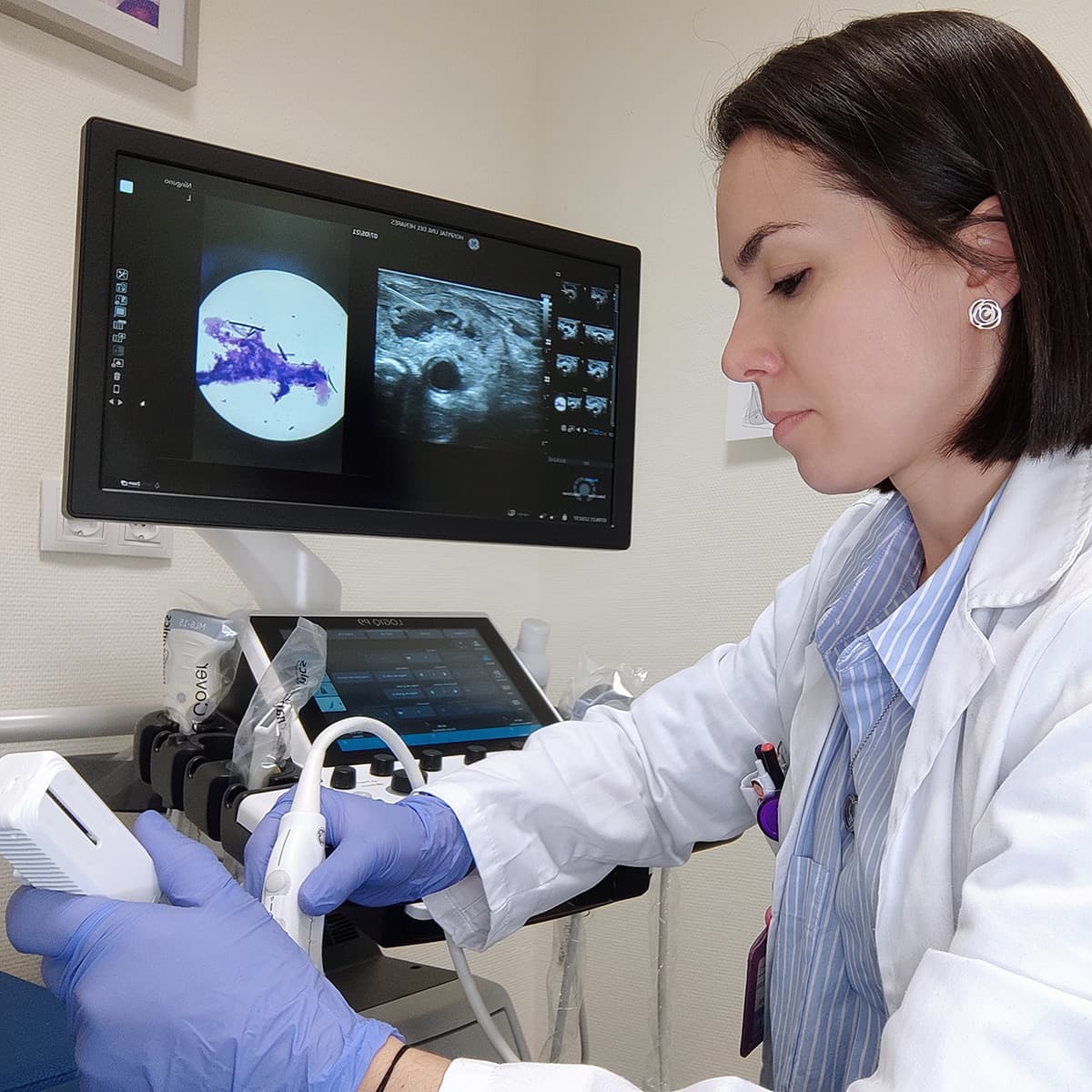 MSK Nodules: The Good, The Bad and The Ugly