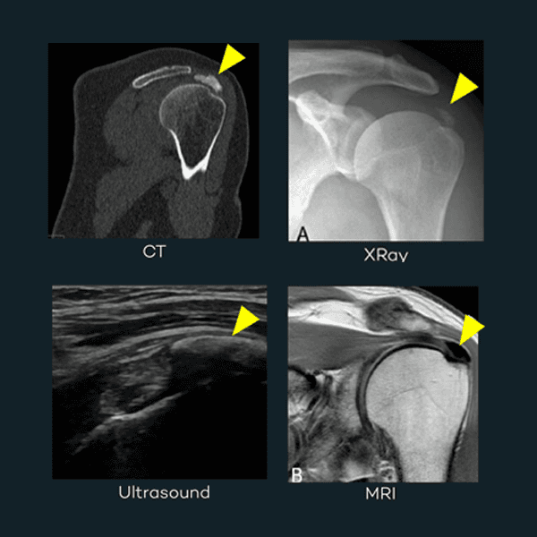 Pathologies in MSK Ultrasound versus other medical imaging techniques