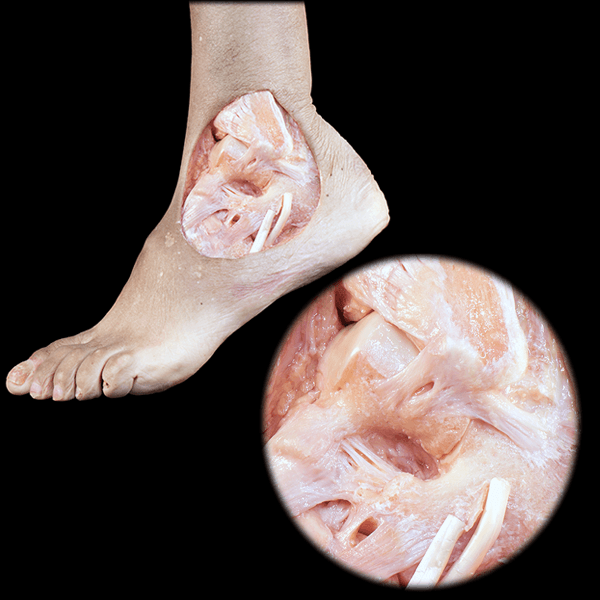 Clinical Anatomy of the Lower Limb