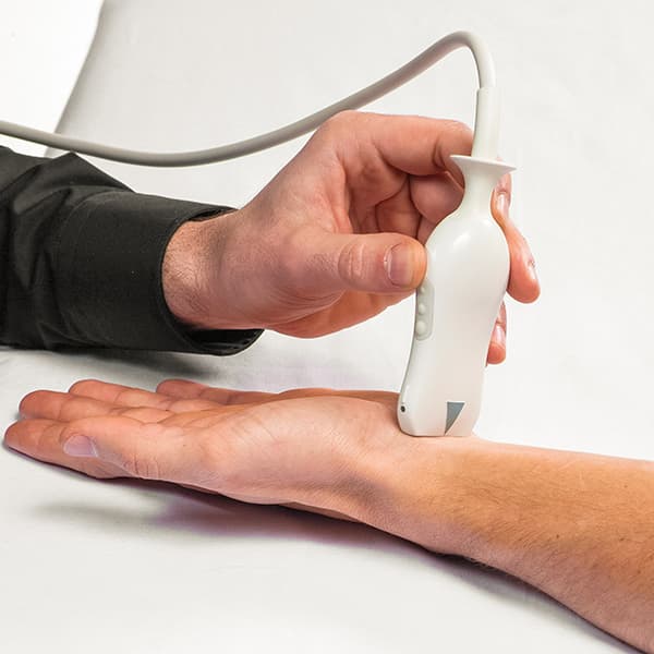 Ultrasound in Carpal Tunnel Syndrome: From diagnose to minimal-invasive release procedures