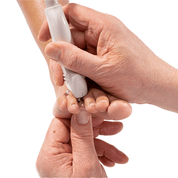 Morton's Neuroma, Beyond the Basics