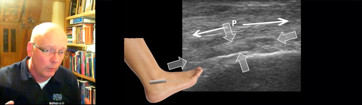Advanced MSK Ultrasound of the Ankle & Foot