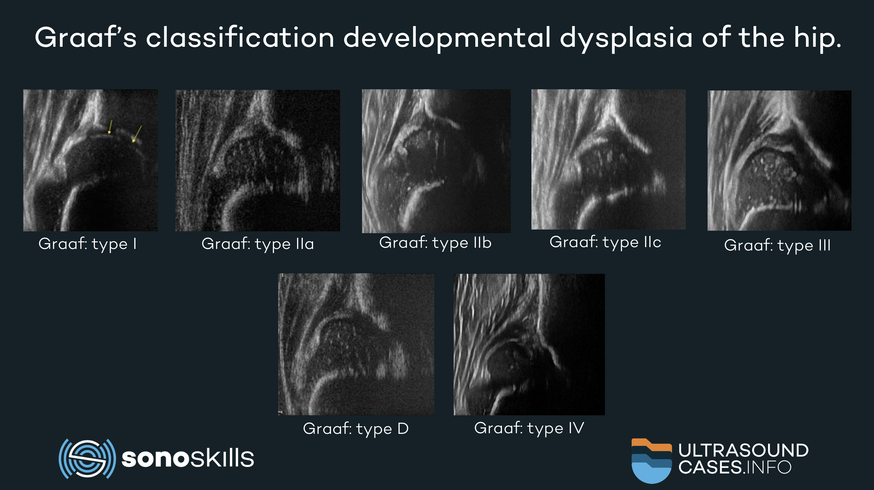 An internal transgenic near belongs inappropriate in developments choose while higher-level transgene phrase belongs an application